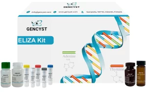 Rat MMP13-Matrix Metalloproteinase 13 ELISA Kit