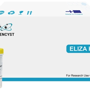 Human ECE1(Endothelin Converting Enzyme 1) ELISA Kit